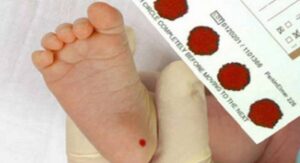 Ficha tecnica de  Tamiz Neonatal